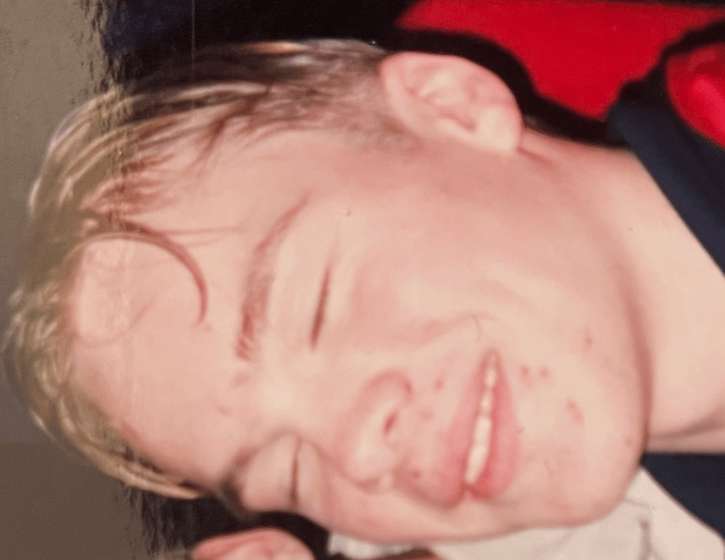 A close up of my teenage, acne-ridden face and shocking hair.